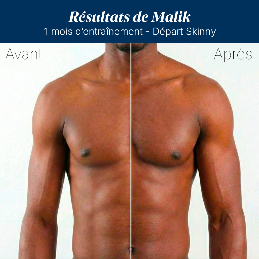 Starter Pack ELEVOR™