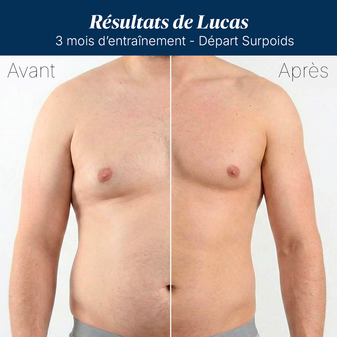 Starter Pack ELEVOR™